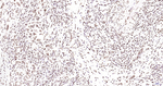 Phospho-JAK2 (Tyr1007, Tyr1008) Antibody in Immunohistochemistry (Paraffin) (IHC (P))
