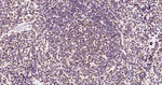 Phospho-JAK2 (Tyr1007, Tyr1008) Antibody in Immunohistochemistry (Paraffin) (IHC (P))