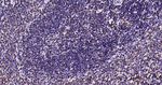 Phospho-JAK2 (Tyr1007, Tyr1008) Antibody in Immunohistochemistry (Paraffin) (IHC (P))