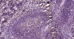 Phospho-JAK2 (Tyr1007, Tyr1008) Antibody in Immunohistochemistry (Paraffin) (IHC (P))