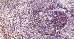 Phospho-JAK2 (Tyr1007, Tyr1008) Antibody in Immunohistochemistry (Paraffin) (IHC (P))
