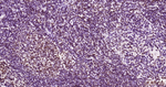 Phospho-JAK2 (Tyr1007, Tyr1008) Antibody in Immunohistochemistry (Paraffin) (IHC (P))