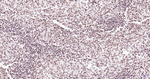 Phospho-JAK2 (Tyr1007, Tyr1008) Antibody in Immunohistochemistry (Paraffin) (IHC (P))