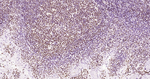 Phospho-JAK2 (Tyr1007, Tyr1008) Antibody in Immunohistochemistry (Paraffin) (IHC (P))