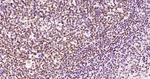 Phospho-JAK2 (Tyr1007, Tyr1008) Antibody in Immunohistochemistry (Paraffin) (IHC (P))