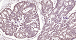 Phospho-JAK2 (Tyr1007, Tyr1008) Antibody in Immunohistochemistry (Paraffin) (IHC (P))