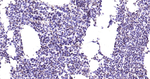 Phospho-JAK2 (Tyr1007, Tyr1008) Antibody in Immunohistochemistry (Paraffin) (IHC (P))