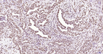 Phospho-JAK2 (Tyr1007, Tyr1008) Antibody in Immunohistochemistry (Paraffin) (IHC (P))