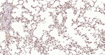 Phospho-JAK2 (Tyr1007, Tyr1008) Antibody in Immunohistochemistry (Paraffin) (IHC (P))