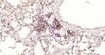 Phospho-JAK2 (Tyr1007, Tyr1008) Antibody in Immunohistochemistry (Paraffin) (IHC (P))