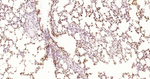 Phospho-JAK2 (Tyr1007, Tyr1008) Antibody in Immunohistochemistry (Paraffin) (IHC (P))