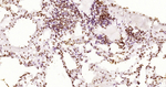 Phospho-JAK2 (Tyr1007, Tyr1008) Antibody in Immunohistochemistry (Paraffin) (IHC (P))
