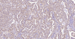 Phospho-YAP1 (Ser127) Recombinant Rabbit Monoclonal Antibody (1H12)