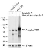 Phospho-YAP1 (Ser127) Antibody in Western Blot (WB)