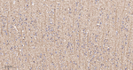 SIRT2 Recombinant Rabbit Monoclonal Antibody (4G12)