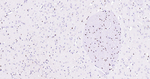 SOX10 Antibody in Immunohistochemistry (Paraffin) (IHC (P))