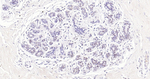 SOX10 Antibody in Immunohistochemistry (Paraffin) (IHC (P))