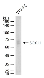 SOX11 Recombinant Rabbit Monoclonal Antibody (1E8)