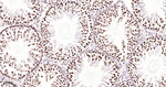 H3K18me1 Antibody in Immunohistochemistry (Paraffin) (IHC (P))