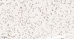 H3K18me1 Antibody in Immunohistochemistry (Paraffin) (IHC (P))