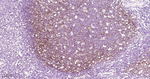 VCAM-1 Antibody in Immunohistochemistry (Paraffin) (IHC (P))