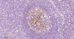 VCAM-1 Antibody in Immunohistochemistry (Paraffin) (IHC (P))