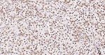 HMGB1 Antibody in Immunohistochemistry (Paraffin) (IHC (P))