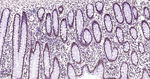HMGB1 Antibody in Immunohistochemistry (Paraffin) (IHC (P))