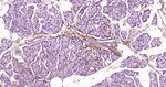 NGFR Antibody in Immunohistochemistry (Paraffin) (IHC (P))