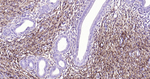 NGFR Antibody in Immunohistochemistry (Paraffin) (IHC (P))