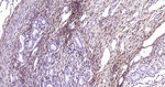 NGFR Antibody in Immunohistochemistry (Paraffin) (IHC (P))