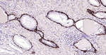 NGFR Antibody in Immunohistochemistry (Paraffin) (IHC (P))