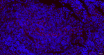 NGFR Antibody in Immunohistochemistry (Paraffin) (IHC (P))