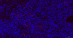 NGFR Antibody in Immunohistochemistry (Paraffin) (IHC (P))