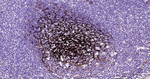 NGFR Antibody in Immunohistochemistry (Paraffin) (IHC (P))