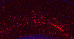 GFAP Antibody in Immunohistochemistry (Paraffin) (IHC (P))