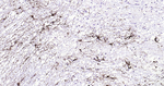 GFAP Antibody in Immunohistochemistry (Paraffin) (IHC (P))