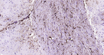 GFAP Antibody in Immunohistochemistry (Paraffin) (IHC (P))