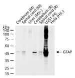 GFAP Antibody in Western Blot (WB)