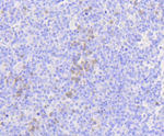 MLKL Recombinant Rabbit Monoclonal Antibody (3G4)