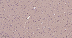 ERK1/2 Antibody in Immunohistochemistry (Paraffin) (IHC (P))