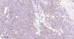 CD29 Antibody in Immunohistochemistry (Paraffin) (IHC (P))