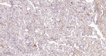 CD29 Antibody in Immunohistochemistry (Paraffin) (IHC (P))