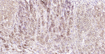 SR-BI Recombinant Rabbit Monoclonal Antibody (1C2)