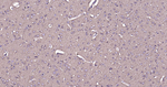 beta Tubulin Antibody in Immunohistochemistry (Paraffin) (IHC (P))