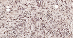 beta Tubulin Antibody in Immunohistochemistry (Paraffin) (IHC (P))