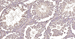 beta Tubulin Antibody in Immunohistochemistry (Paraffin) (IHC (P))