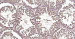 beta Tubulin Antibody in Immunohistochemistry (Paraffin) (IHC (P))