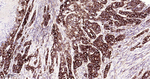 Phospho-EIF2A (Ser51) Antibody in Immunohistochemistry (Paraffin) (IHC (P))