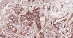 Phospho-EIF2A (Ser51) Antibody in Immunohistochemistry (Paraffin) (IHC (P))